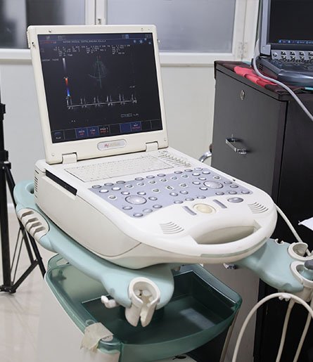 Cardiac Intensive Care ICU